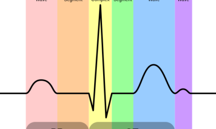 Electrocardiograma o ECG: observa tu corazón